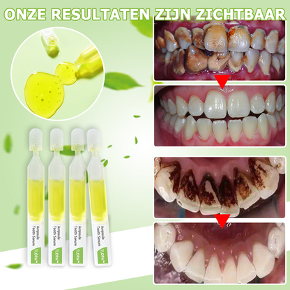 ClearShine™ | Sérum de blanchiment des dents 