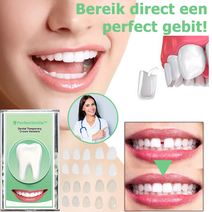 PerfectSmile™ | Faccetta per corone dentali provvisorie 