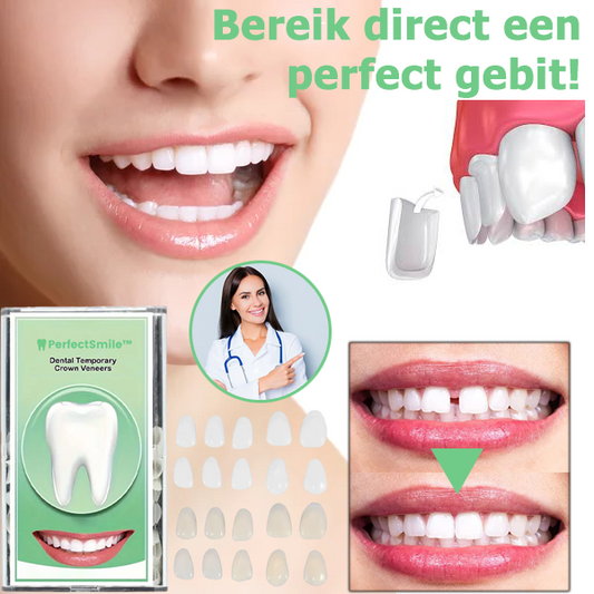 PerfectSmile™ | Tandheelkundige tijdelijke kroonfineer