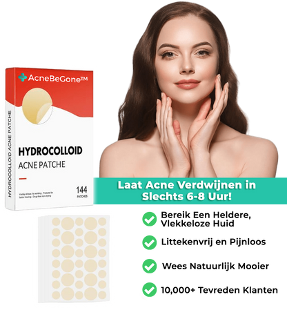 AcneBeGone™ Hydrocolloïde Acnepleister