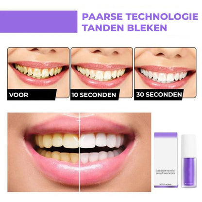 UltraWit™ | Paarse Tandenbleek Serum