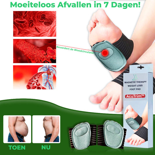 AcuTrim™ | Acupoint Magnetische Massage Therapie Gewichtsverlies Voet Pad