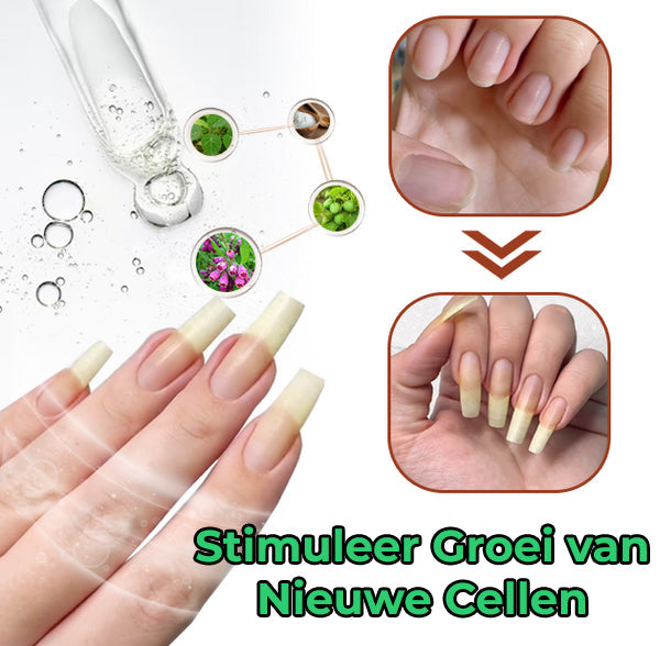 NailFix™ | Nagelgroei & Versterkend Gel