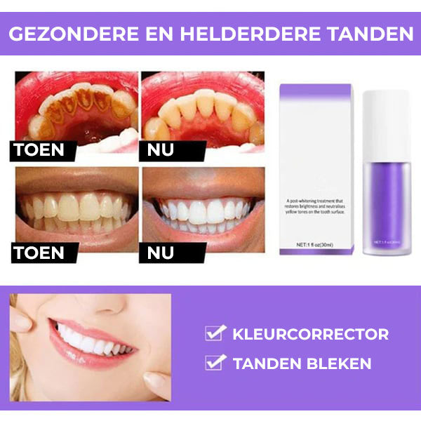 UltraWit™ | Paarse Tandenbleek Serum