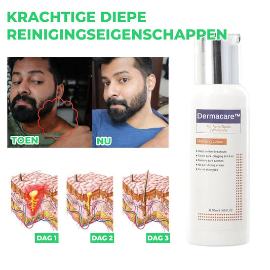 Dermacare™ | Reinigingslotion voor Acne & Vlekken