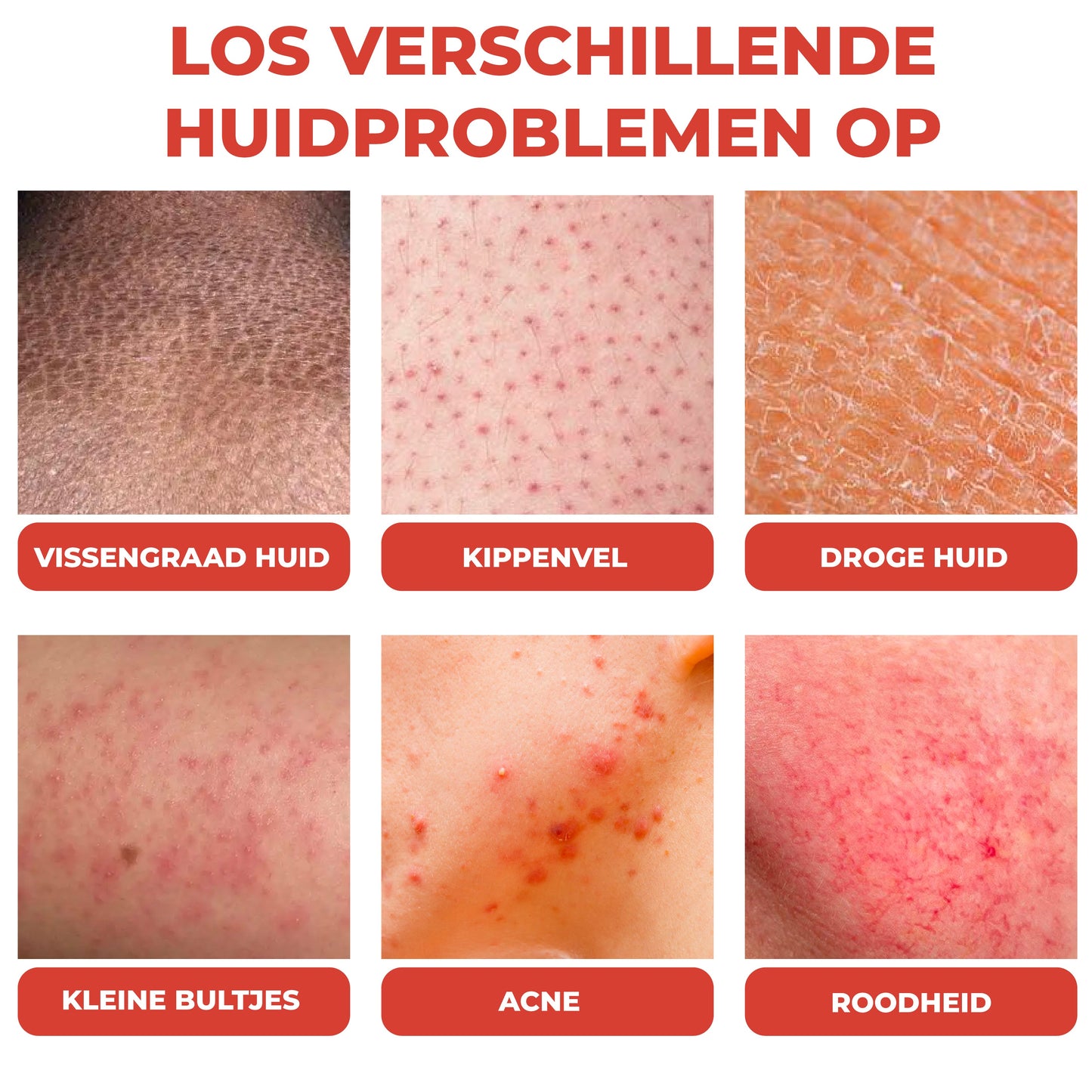 HuidHeeler™ | Acne & Keratosis Reinigingscrème