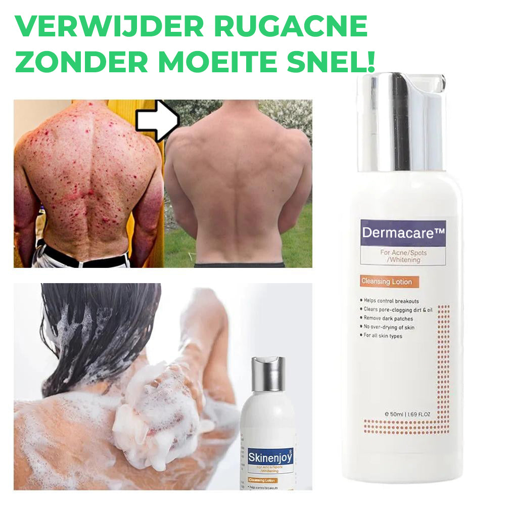 Dermacare™ | Reinigingslotion voor Acne & Vlekken