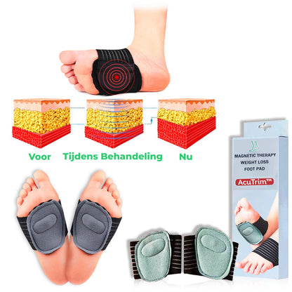 AcuTrim™ | Acupoint Magnetische Massage Therapie Gewichtsverlies Voet Pad