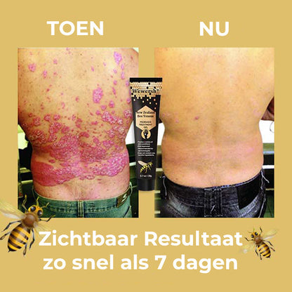 SnelHerstel™ | Bijengifextract