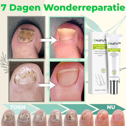 NailFix™ | Nagelgroei & Versterkend Gel