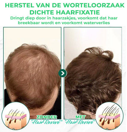 HairRevive™ | Haar voedend serum