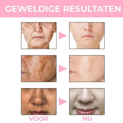 YouthVial™ | Melanine Corrigerend Gezichtsserum