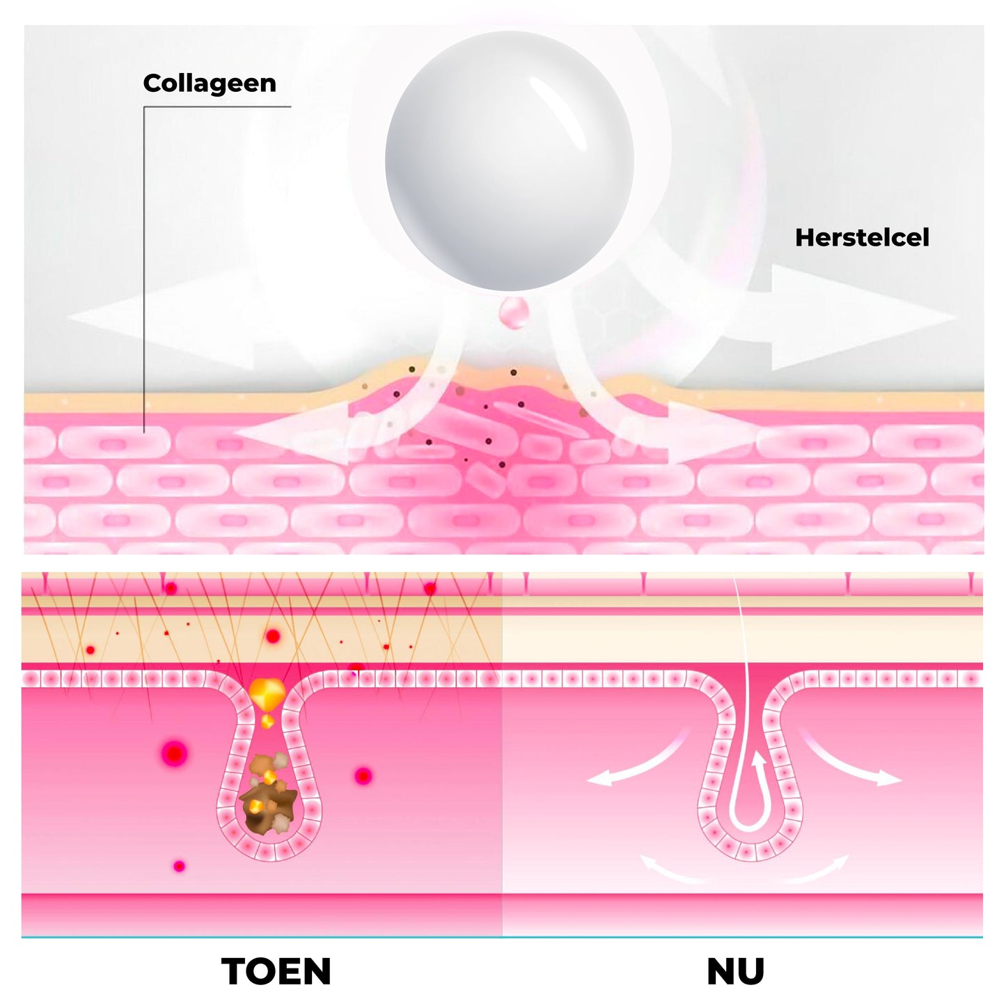 HuidHeeler™ | Acne & Keratosis Reinigingscrème