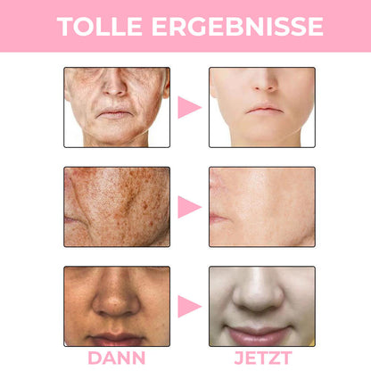 EeuwigeJeugd™ | Anti Vlekken & Fijne Lijnen Serum