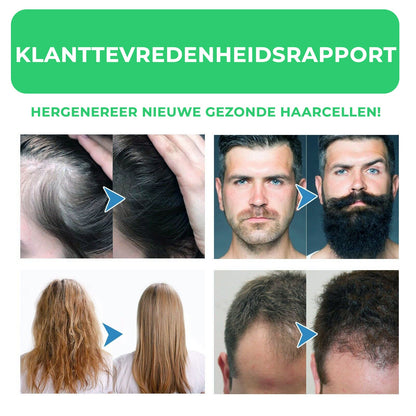 HairRevive™ | Haar voedend serum