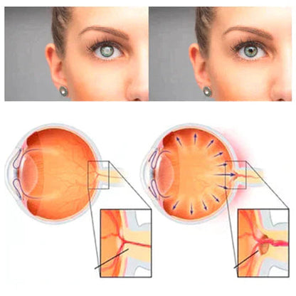 OptiCrystal™ | Verfrissende Oogproblemen Oplossingsdruppels