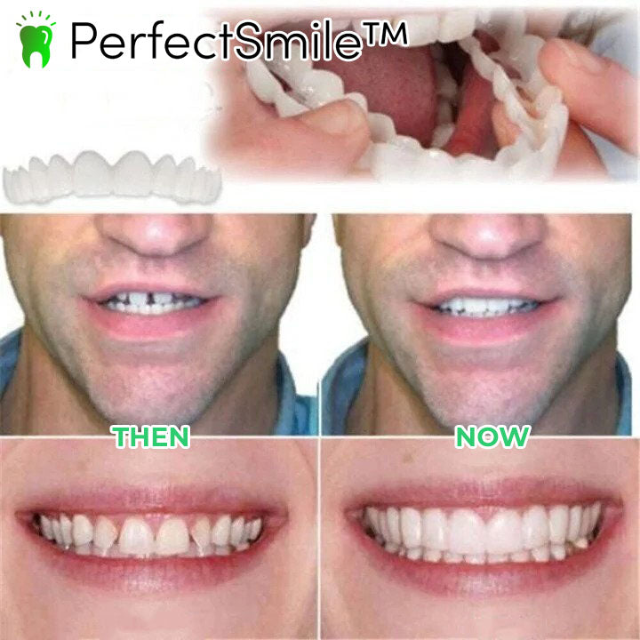 PerfectSmile™ | Dental bracket