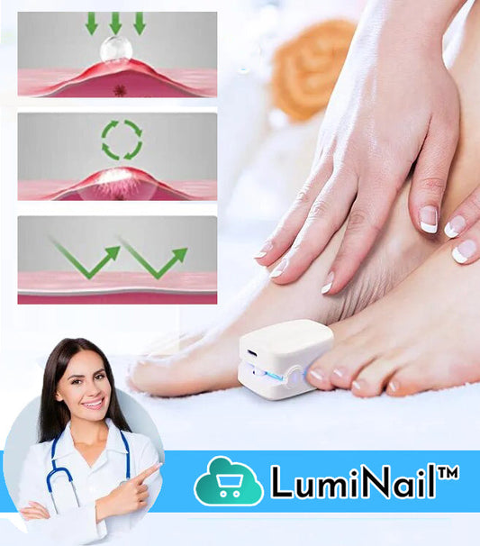 LumiNail™ | Hoogrendements Lichttherapie Apparaat Voor Teennagelziekten!