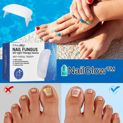 NailGlow™ | Lichttherapie-apparaat tegen Nagelschimmel