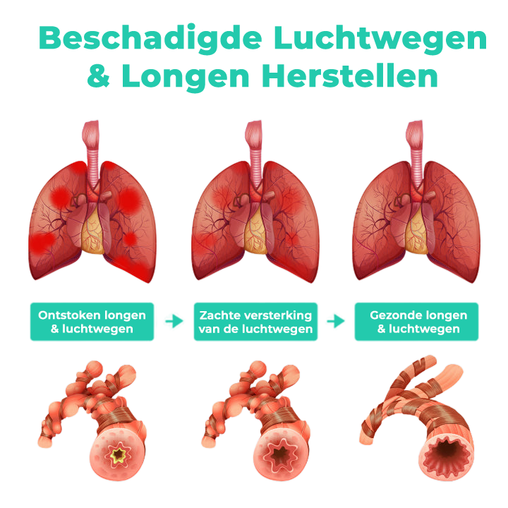 LungLive™ | Long Kruiden Respiratoire Ondersteuning Spray