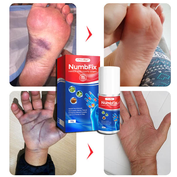 NerveEase™ | Neuropathie Hand- & Voetspray